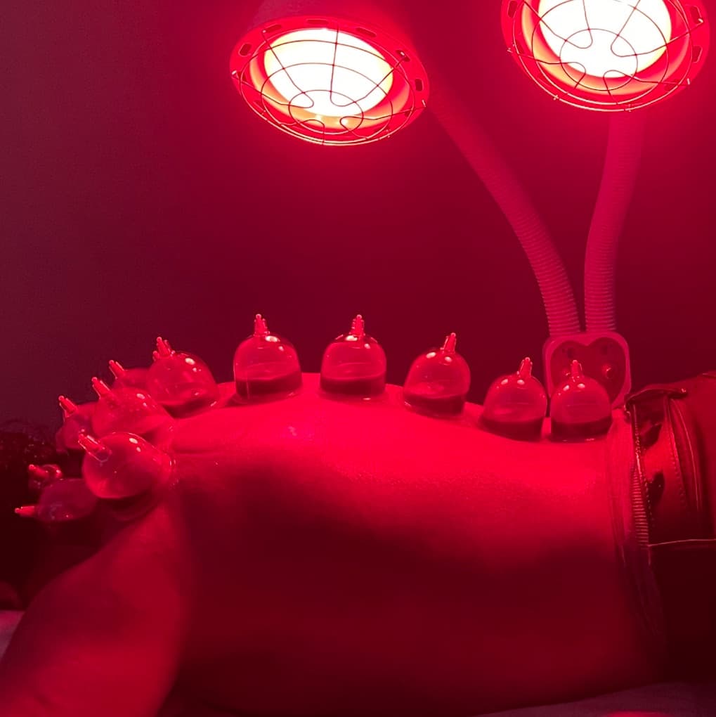 Cupping glasses in place along a client's back under two red light therapy lamps partway through a hijama session
